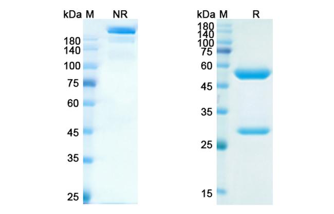 Serplulimab Humanized Antibody in SDS-PAGE (SDS-PAGE)