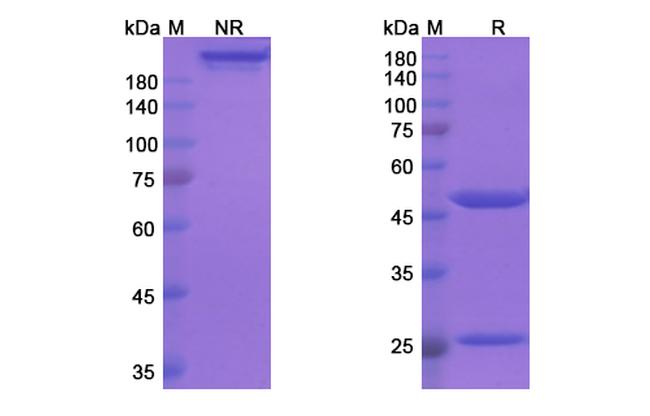 PCSK9 (Tafolecimab Biosimilar) Antibody in SDS-PAGE (SDS-PAGE)