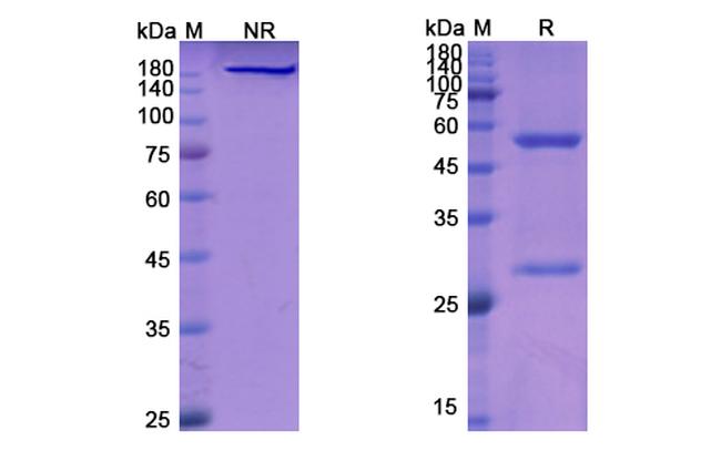 CD20 (Veltuzumab Biosimilar) Antibody in SDS-PAGE (SDS-PAGE)