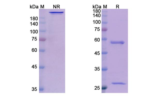 Human IgE (Talizumab Biosimilar) Antibody in SDS-PAGE (SDS-PAGE)