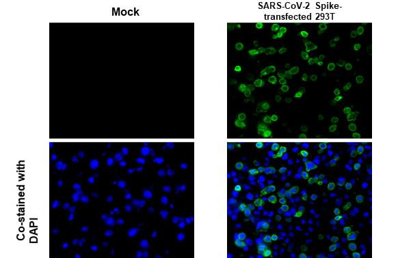 SARS/SARS-CoV-2 Spike Protein S2 Antibody in Immunohistochemistry (Paraffin) (IHC (P))