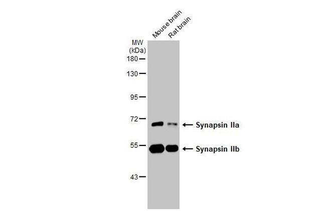 Synapsin II Monoclonal Antibody (GT387) | Invitrogen (MA5-42340)