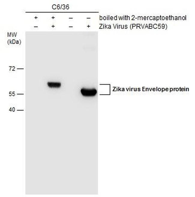 Zika Virus Envelope Protein Monoclonal Antibody (GT363) (MA5-42346)