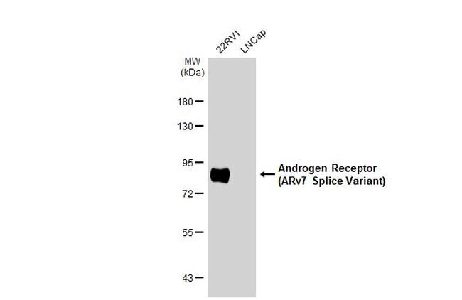 Androgen Receptor (ARv7 Splice Variant) Antibody in Western Blot (WB)
