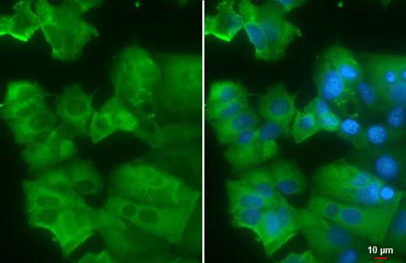 AGR2 Antibody in Immunocytochemistry (ICC/IF)