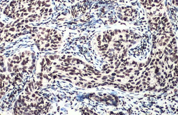 Phospho-ATM (Ser1981) Antibody in Immunohistochemistry (Paraffin) (IHC (P))