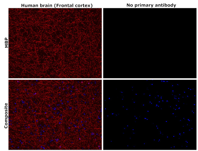 MBP Antibody in Immunohistochemistry (Paraffin) (IHC (P))