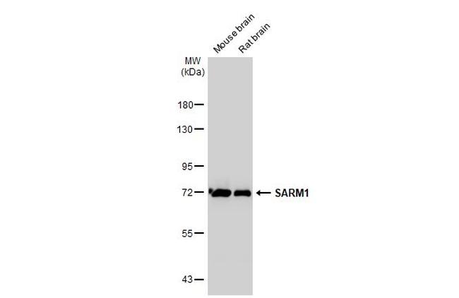 SARM Antibody in Western Blot (WB)