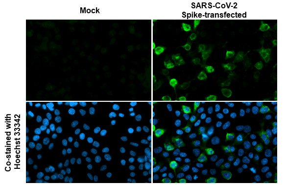 SARS-CoV-2 Spike Protein S2 Antibody in Immunocytochemistry (ICC/IF)