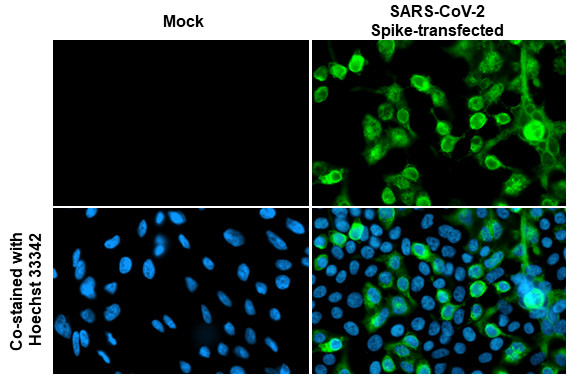 SARS/SARS-CoV-2 Spike Protein S2 Antibody in Immunocytochemistry (ICC/IF)