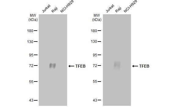 TFEB Antibody in Western Blot (WB)