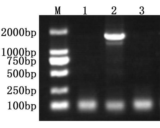 Taq DNA Polymerase Antibody in Functional Assay (Functional)