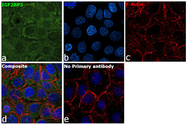 IGF2BP3 Antibody in Immunocytochemistry (ICC/IF)