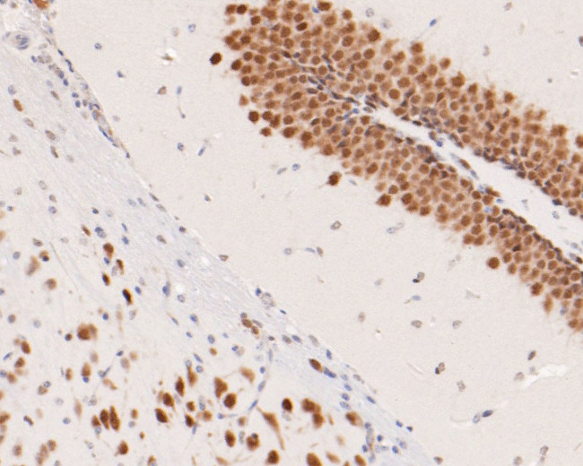 CUG-BP2 Antibody in Immunohistochemistry (Paraffin) (IHC (P))