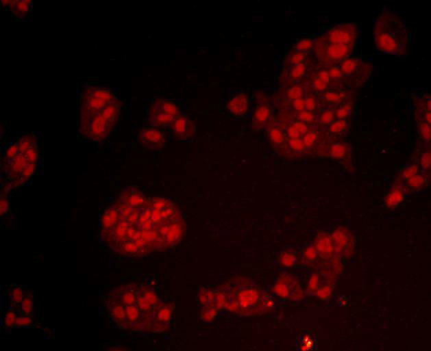 BMI-1 Antibody in Immunocytochemistry (ICC/IF)