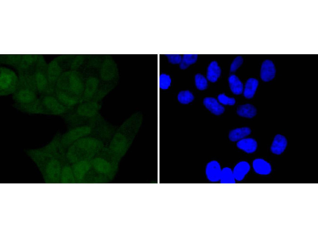 Phospho-IkB alpha (Ser32) Antibody in Immunocytochemistry (ICC/IF)