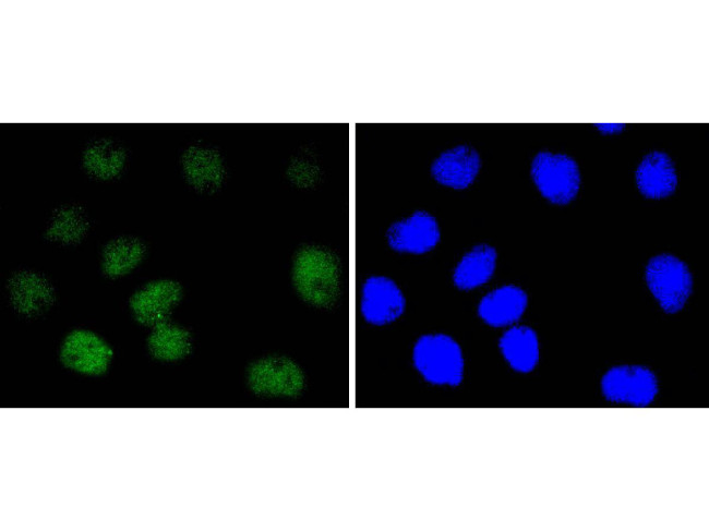 NBS1 Antibody in Immunocytochemistry (ICC/IF)