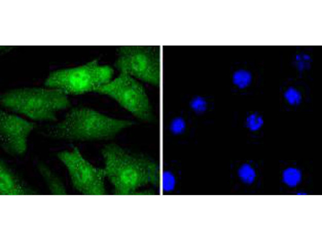 Cyclin E2 Antibody in Immunocytochemistry (ICC/IF)