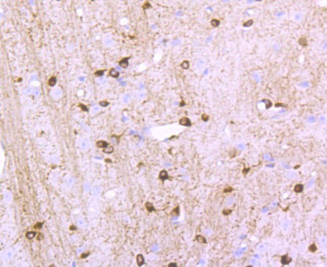 NMDAR1 Antibody in Immunohistochemistry (Paraffin) (IHC (P))