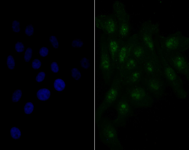 Nucleostemin Antibody in Immunocytochemistry (ICC/IF)