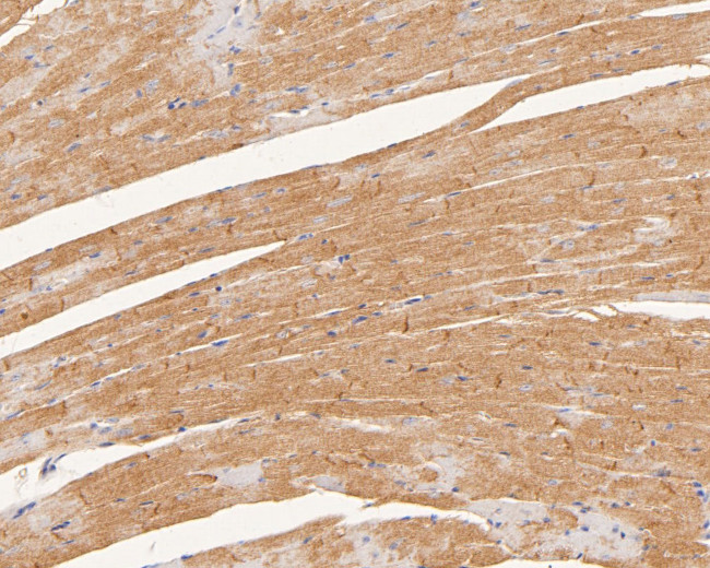 CTNNA3 Antibody in Immunohistochemistry (Paraffin) (IHC (P))