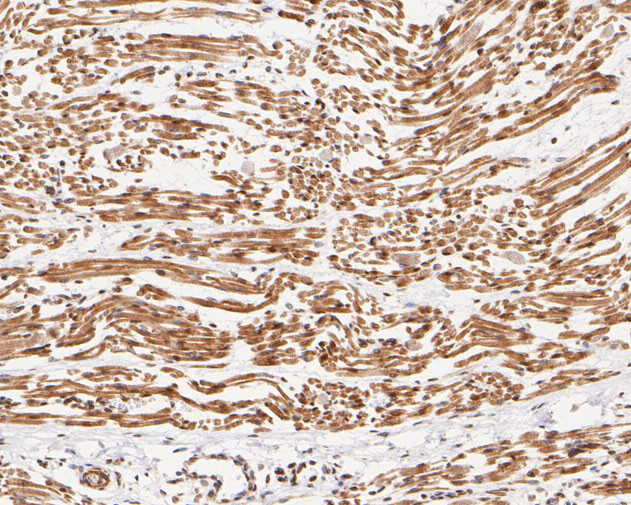 UBE2B Antibody in Immunohistochemistry (Paraffin) (IHC (P))