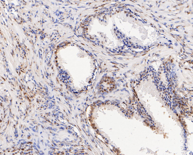 CIRBP Antibody in Immunohistochemistry (Paraffin) (IHC (P))