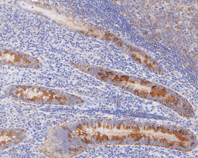 CC2D1A Antibody in Immunohistochemistry (Paraffin) (IHC (P))