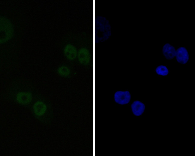 CtBP2 Antibody in Immunocytochemistry (ICC/IF)
