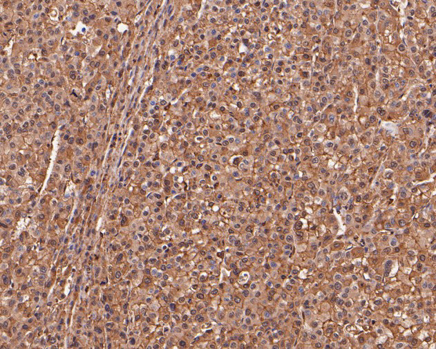 MRPL28 Antibody in Immunohistochemistry (Paraffin) (IHC (P))