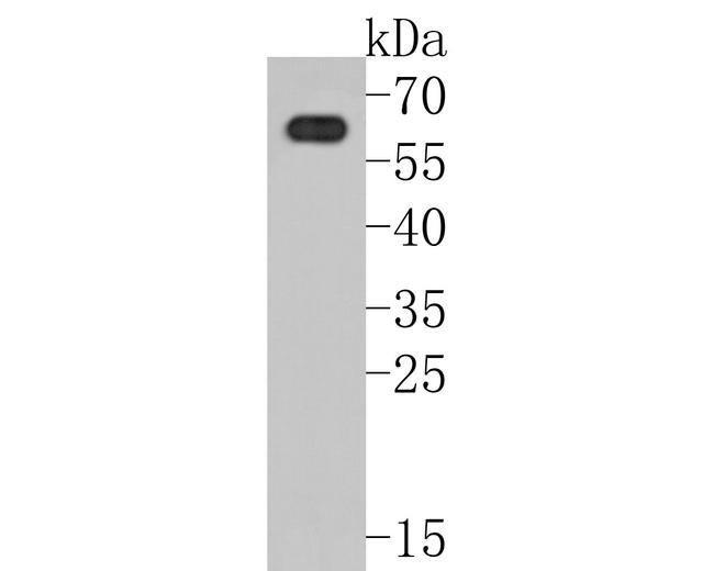 PAK3 Antibody in Western Blot (WB)