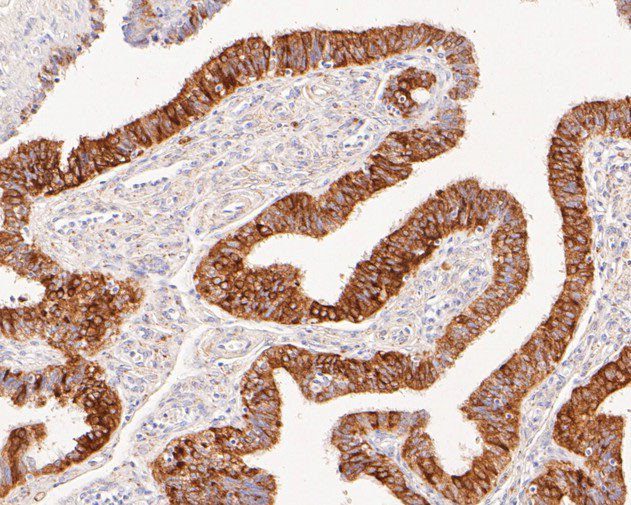 CLGN Antibody in Immunohistochemistry (Paraffin) (IHC (P))
