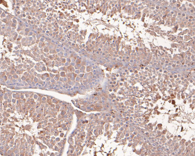 Nsun4 Roster NSUN4 Monoclonal Antibody (4G4) | Invitrogen (MA5-42532)