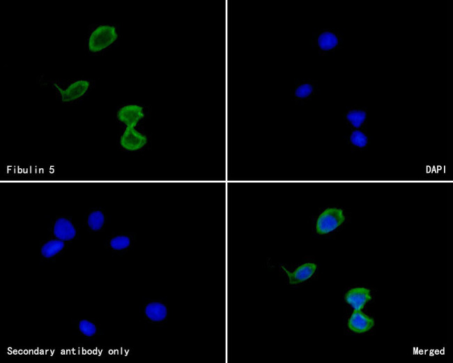Fibulin 5 Antibody in Immunocytochemistry (ICC/IF)