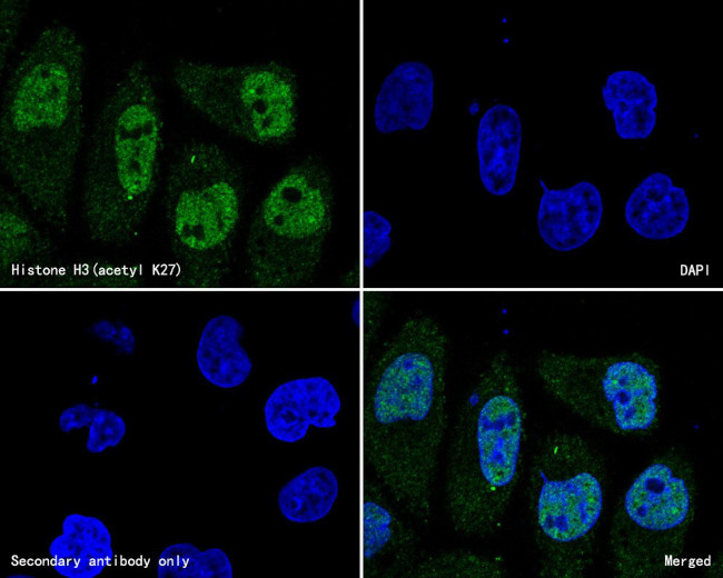 H3K27ac Antibody in Immunocytochemistry (ICC/IF)
