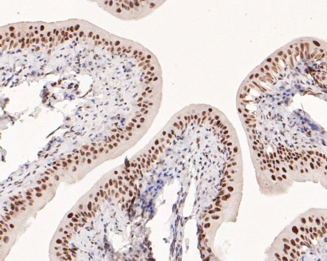 POLR2A Antibody in Immunohistochemistry (Paraffin) (IHC (P))