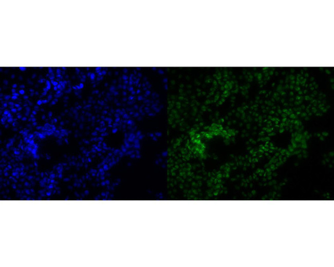 POLR2A Antibody in Immunocytochemistry (ICC/IF)