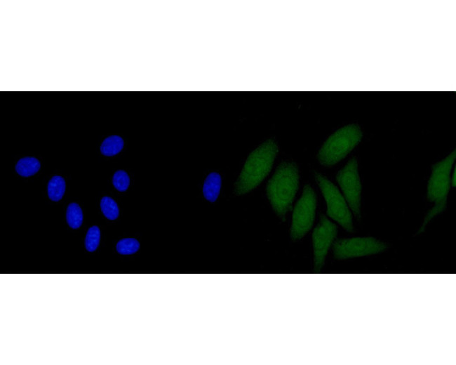 CLIC2 Antibody in Immunocytochemistry (ICC/IF)