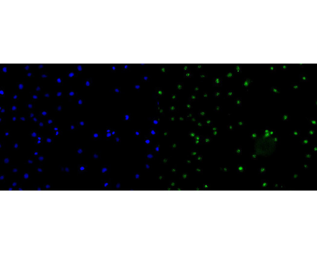 CENPB Antibody in Immunocytochemistry (ICC/IF)