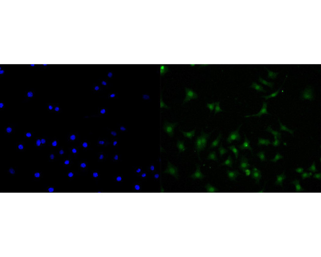 CENPB Antibody in Immunocytochemistry (ICC/IF)