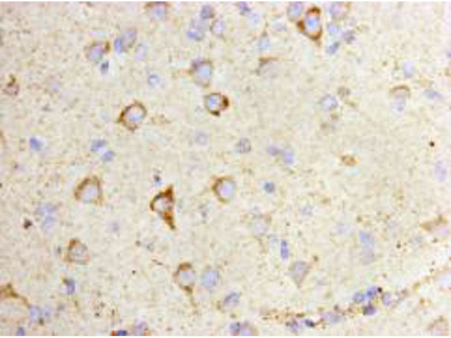 CD80 (B7-1) Antibody in Immunohistochemistry (Paraffin) (IHC (P))