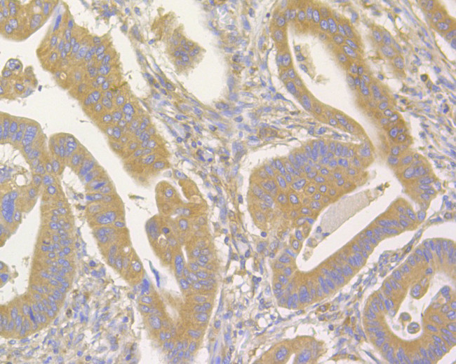 FAM62B Antibody in Immunohistochemistry (Paraffin) (IHC (P))
