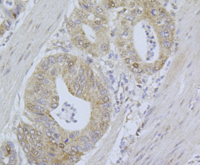 CDK4 Antibody in Immunohistochemistry (Paraffin) (IHC (P))