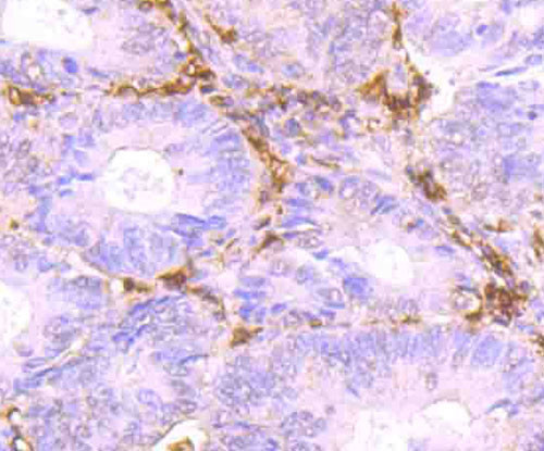 HLA-DR Antibody in Immunohistochemistry (Paraffin) (IHC (P))