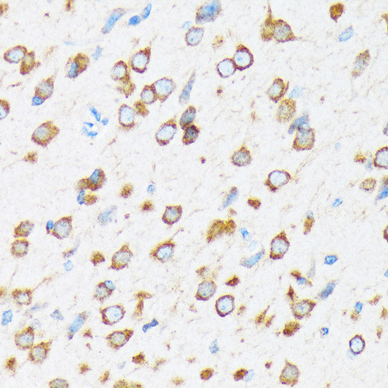ELP3 Antibody in Immunohistochemistry (Paraffin) (IHC (P))