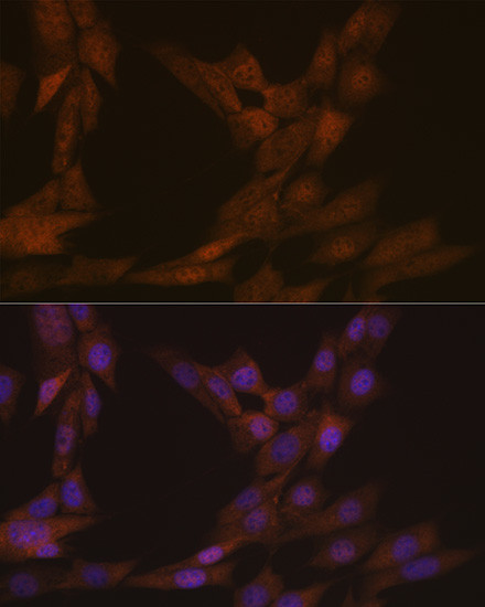 KIFC1 Antibody in Immunocytochemistry (ICC/IF)