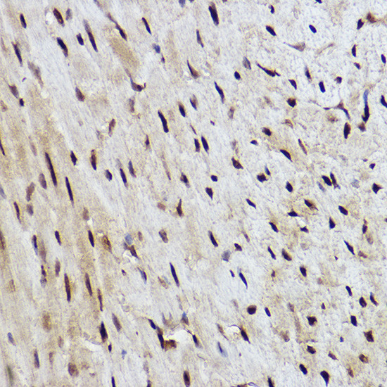 RANBP3 Antibody in Immunohistochemistry (Paraffin) (IHC (P))