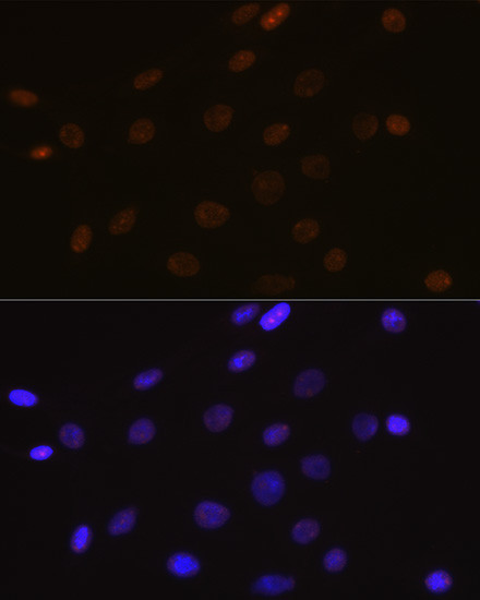 DEK Antibody in Immunocytochemistry (ICC/IF)