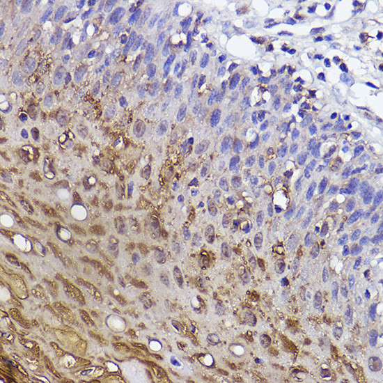 SERPINB3 Antibody in Immunohistochemistry (Paraffin) (IHC (P))