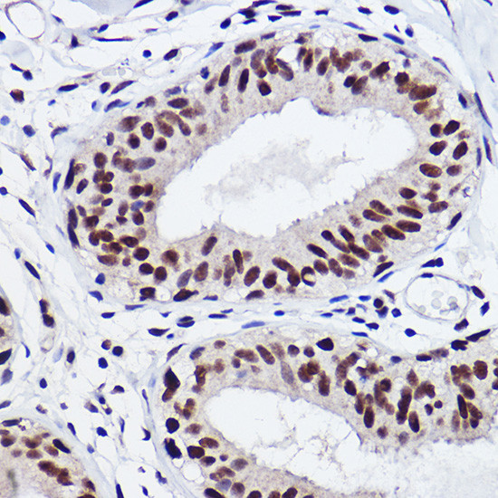 GTF2I Antibody in Immunohistochemistry (Paraffin) (IHC (P))